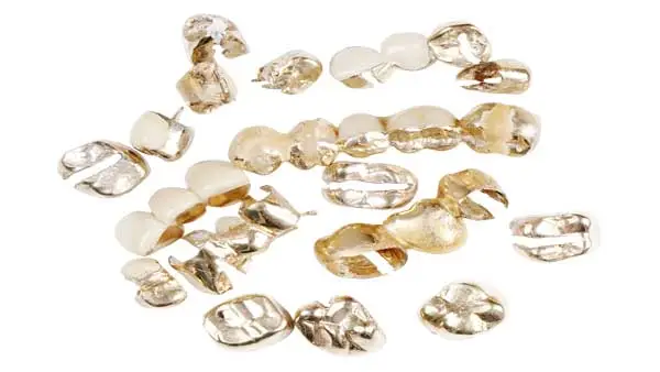 Zahngoldankauf Zahngold- und Dentalgold-Prothesen auf hellem Hintergrund